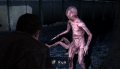 GC 09 > Silent Hill pose sur Wii