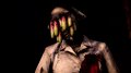 E3 08 > La dose de Siren : Blood Curse